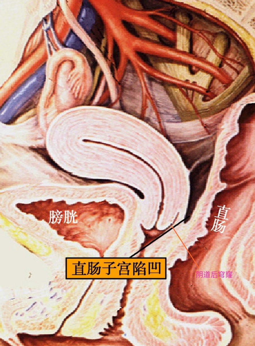 Pasted image 20250616084837.jpg